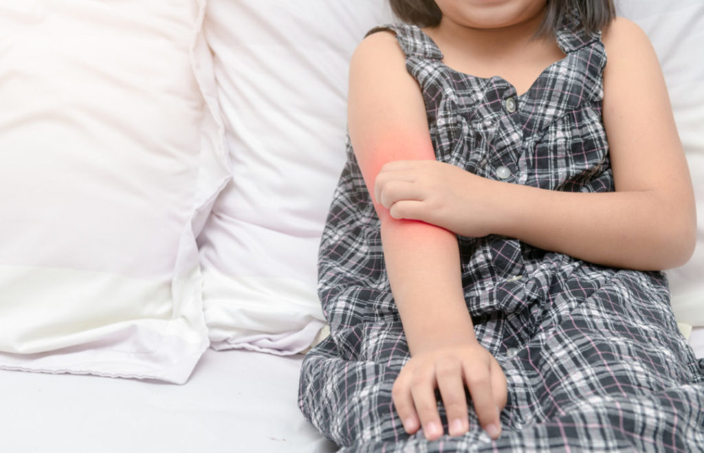 子どもが帯状疱疹にかかったら 対処法を解説 人にうつる 学校は ベビママほっと